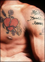 Tattooentfernung Beitragsbild Tattooentfernung