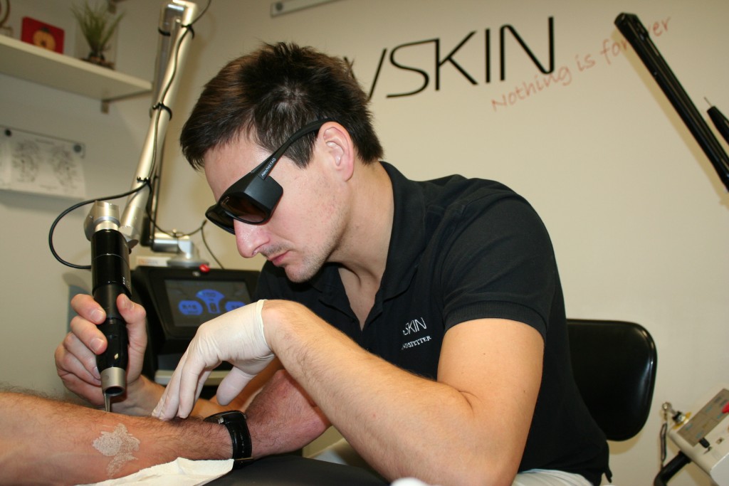 Dr. Matthias Brandstetter bei einer Laser-Tattooentfernung