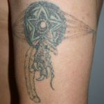 Newskin - Tattooentfernung in Traun bei Linz|Vorher-/Nachherbilder