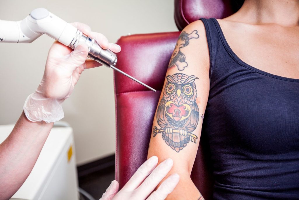 Newskin - Tattooentfernung in Traun bei Linz|Startseite