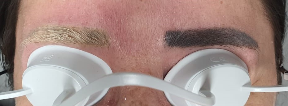 Newskin - Tattooentfernung in Traun bei Linz|Permanent Makeup