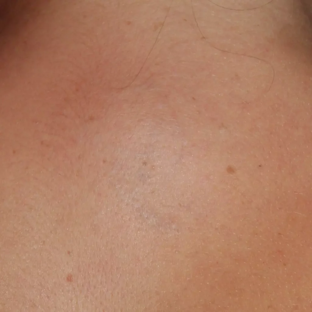 Resultat Chinesisches Zeichen Tattoo