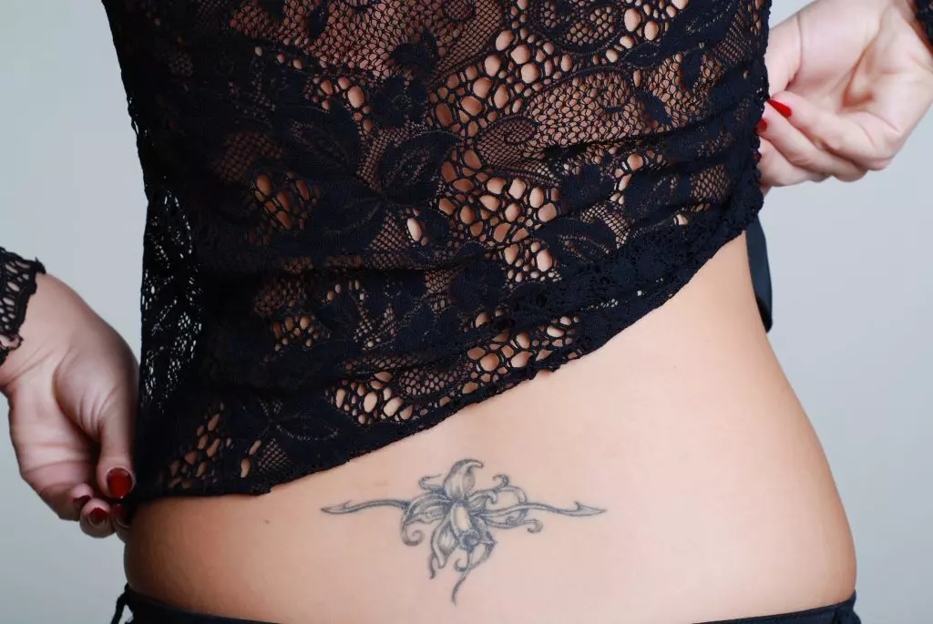Tattooentfernung |  - FAQ’s